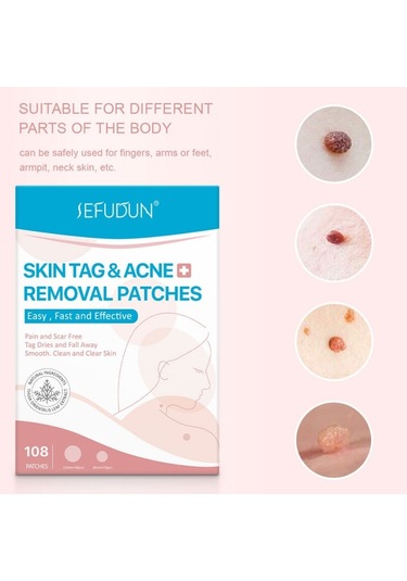 108 Adet Cilt Etiketi Akne Kaldırma Yamalar Ağrısız Pürüzsüz Temiz Temizle Cilt Hızlı Sökücü Sivilce Siğil Ana Yama Tedavisi Korur