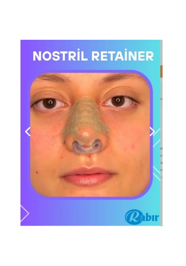 Burun Deliği Şekil + 3m Estetik Burun Ba...