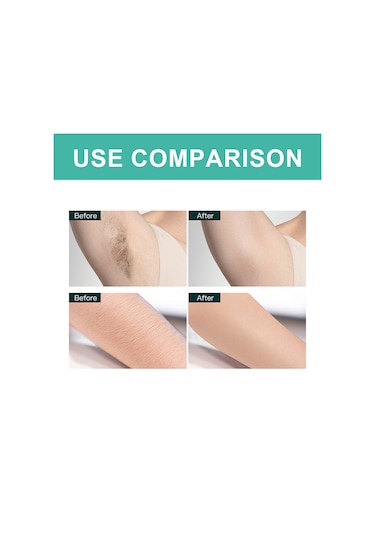 Moveevo West&month Tüy Alma Ağda Kağıdı Wea06-a030-1-og1