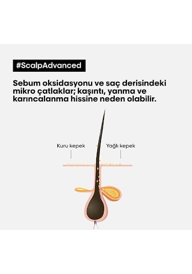 L'Oréal Professionnel Serie Expert Scalp Advanced Kepek Karşıtı Profesyonel Şampuan 500 ML
