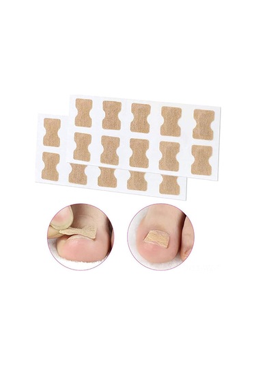 Wezone Nefes Alabilen Tırnak Düzeltme Yapışkanları - 10 Adet 100 Yapışkan, Batık Tırnak Tedavisi İçin Pratik Çözüm