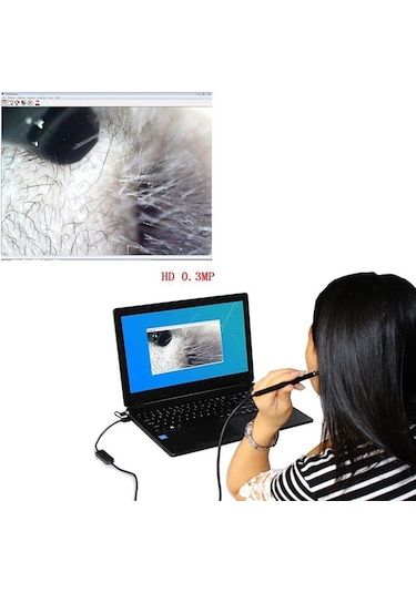 Kulak Muayene Endeskop Kamera 720P 3 in 1 Usb  Görsel Kulak Temiz