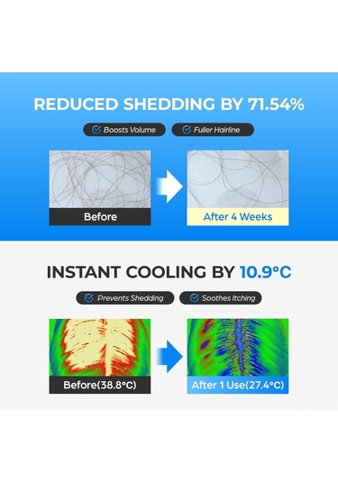 Hangfox Deniz Yosunu Saç Kökü Serumu - Derin Temizleme, Kök Güçlendirme, Dökülmeyi Azaltma, Nane Özlü Rahatlatıcı Saç Sağlığı Geliştirici