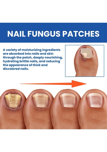 Geekyou 32 Adet Tırnak Mantar İyileştirici Yama - Glyserin Ve Çay Ağacı Yağı İçeren Tırnak Onarım Bandı