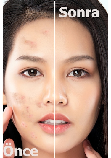 Devida Leke Karşıtı Aydınlatıcı Canlandırıcı Serum BrightFix Series A200 30 ML