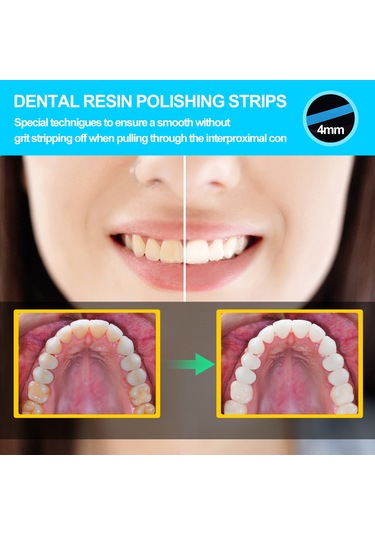 Skycity Dental İki Adet Mavi İnce Zımpara Şeridi - Dişler İçin Parlatma Ve Taşlama