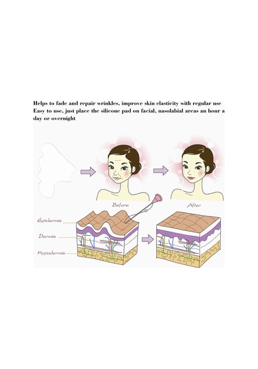 Vkemall Yenilikçi Silikon Yüz Maskesi: Nazolabial Kırışıklıklar Ve Dudak Çevresi İçin Etkili Çözüm