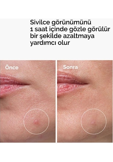 The Ordinary Sulfur 10% Powder-to-cream Concentrate