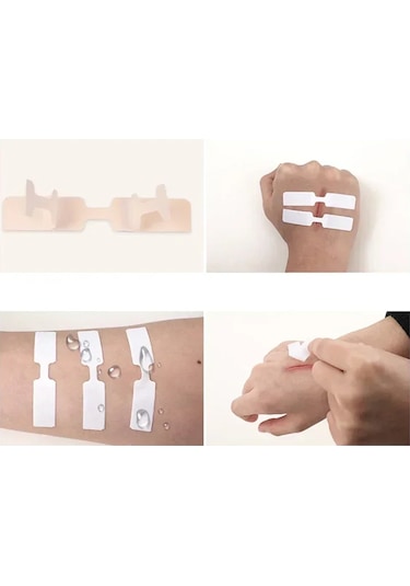 10 Adet/torba Su Geçirmez Bant Yardımı Kelebek Yapışkanlı Yara Kapatma Bandı Yardım Acil Durum Kiti Yapışkanlı Bandajlar İlk Yardım Çantası Taktik