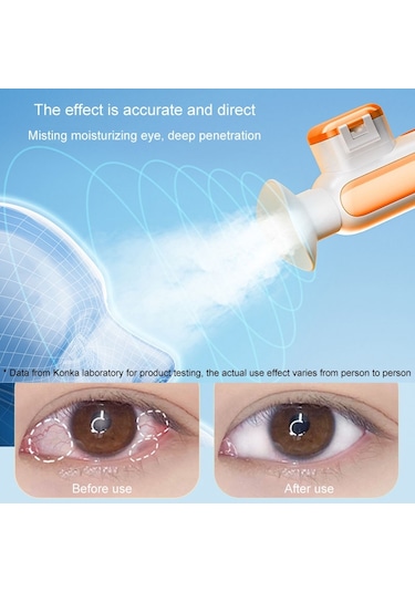 Konka Sıcak Ve Soğuk Kompres Sisleme Göz Nemlendirici Sprey Buharlı Pişirici El Tipi Göz Sisleme Aleti Beyaz Çok Renkli
