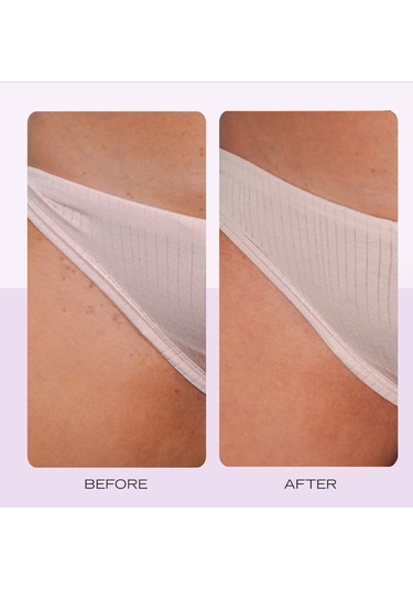 First Aid Beauty Ingrown Hair Pads - Batık Tüyler İçin Biyolojik Olarak Bozunabilen Diskler X60