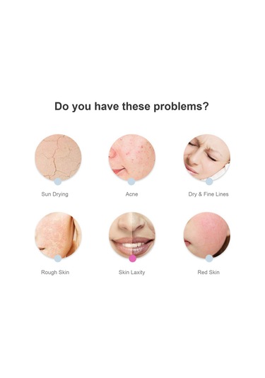 Samdoo Pembe Cilt Bakımı Bıçakcığı - Dıy Buzlu Masaj Aleti: Tonu Parlatır, Kuru İzleri Giderir, Ödemleri Azaltır Çok Renkli