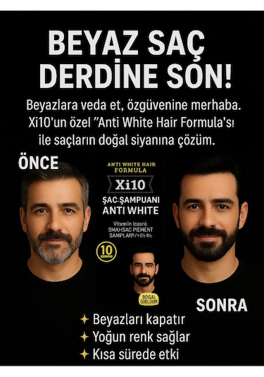 Xi10 Beyaz Kapatan Şampuan 300 ML