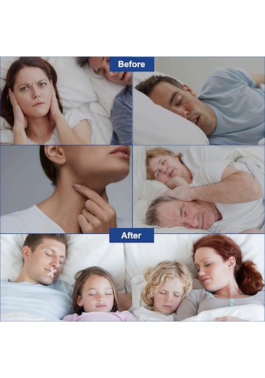 Hangfox Uykuda Açık Ağız Engelleme Bantları - Solunum Düzeltici Uyku Yardımcıları, Transparent Eva Malzeme, 120 Adet