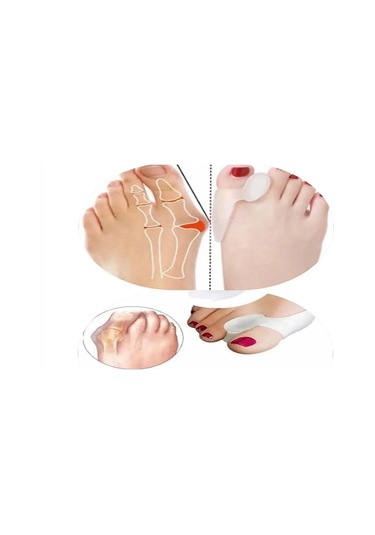 Ozclife Ayak Başparmak Koruyucu Kemik Çıkıntısı Önleyici