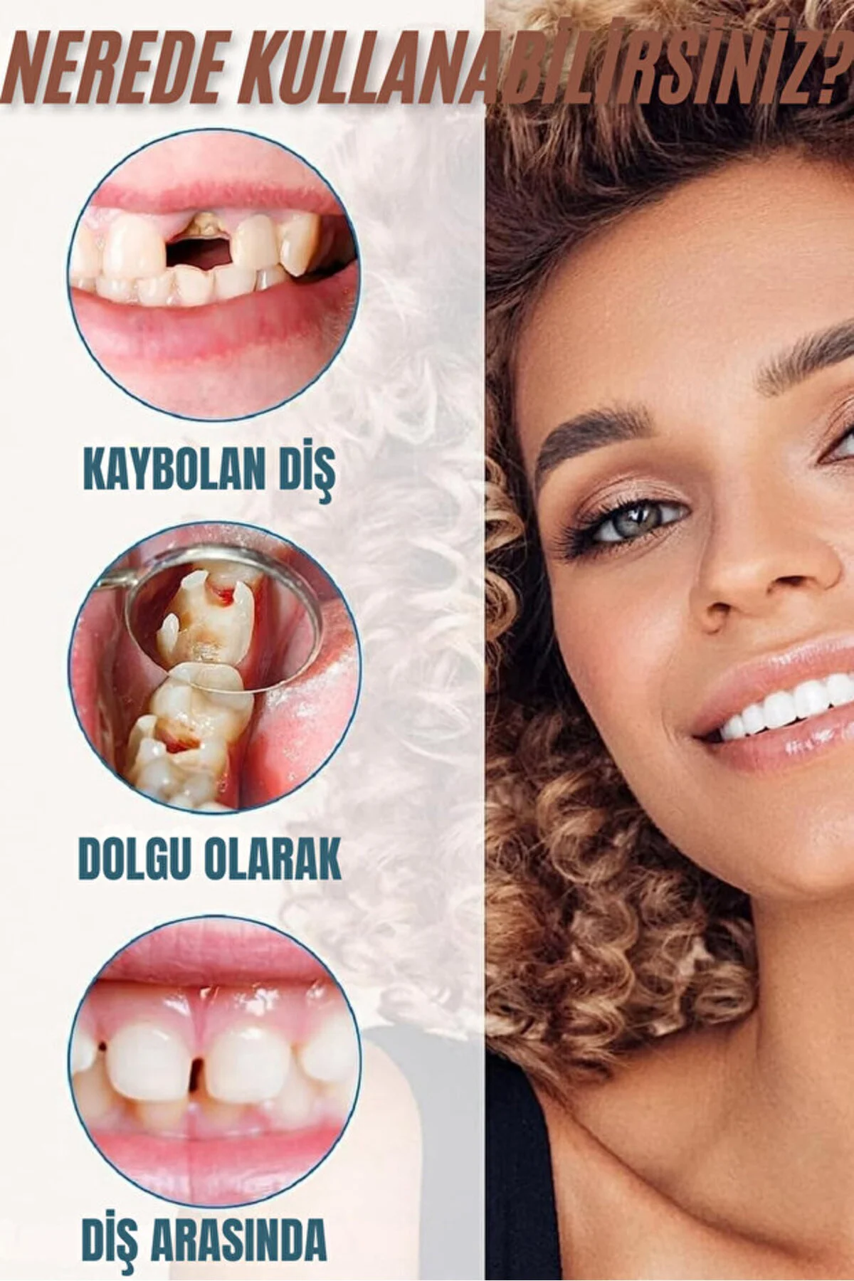 Moldable Vivostar Takma Diş, Protez Diş, Diş Dolgusu, Geçici Diş,