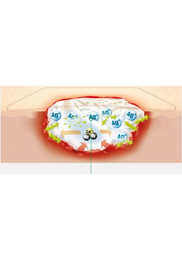 LR Suprasorb 20572 A+Ag Antimikrobiyal Kalsiyum Aljinat Yara Örtüsü