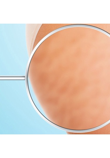 Soillium Doğal At Kılı Selülit Fırçası