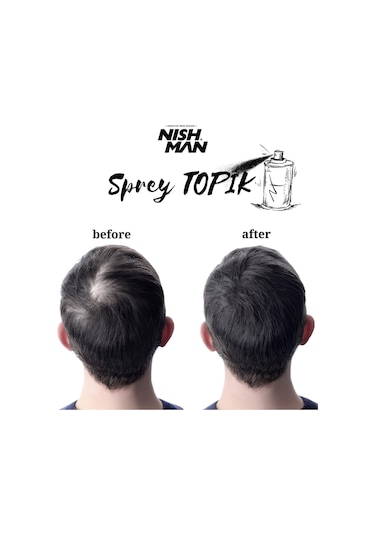 Nish Man Saç Dolgunlaştırıcı ve Seyrek Kapatıcı Root Touch Up Sprey 100 ML