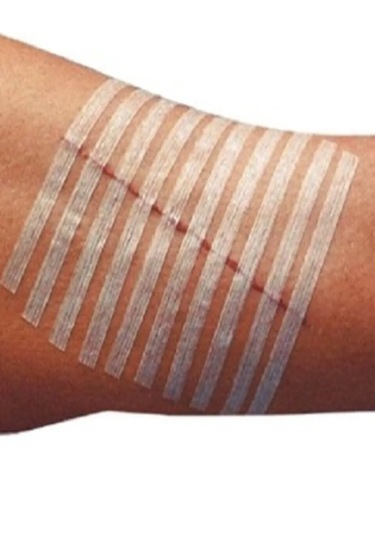 Seyitler Kimya Maxı-strıp Yara Kapatma Şeridi 6.4x102mm