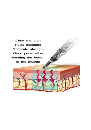 Teltree Elektrikli Akupunktur Kalemi: Otomatik Nokta Bulma Ve Enerji Döngüsü İle Evde Ağrı Alleviatörü Çok Renkli