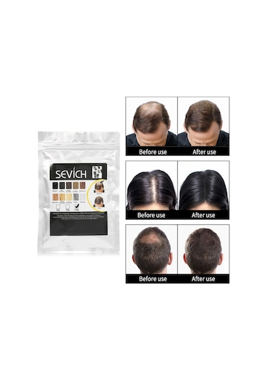 Sevich 100 Gr Siyah Orta Koyu Kahve Saç Fiberi Keratin Saç Tozu