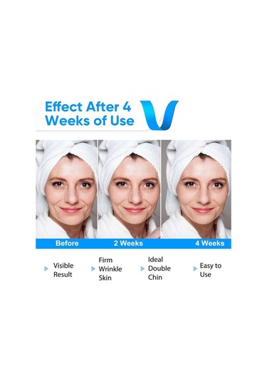 Youtek Elektrikli V-yüz Şekillendirici Masaj Aleti - Çene Ve Yüz Sıkılaştırma Cihazı