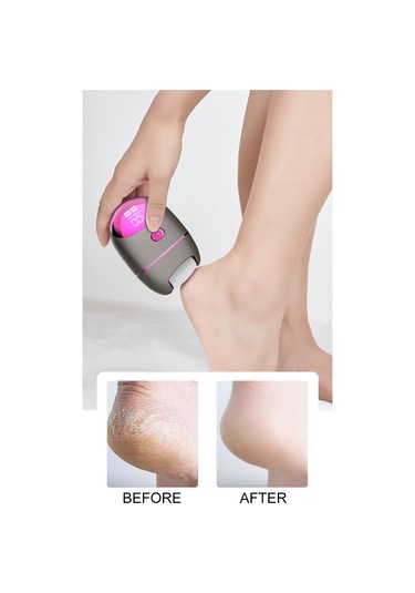 Moveevo Elektrikli Ayak Öğütücü Elektronik Ölü Deri Temizleme Ayak Bakım Aletleri Tırnak Sanatı Cilt Pürüzsüz Ayak