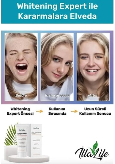İlla Life Cilt Beyazlatıcı Leke Kremi 50 ML