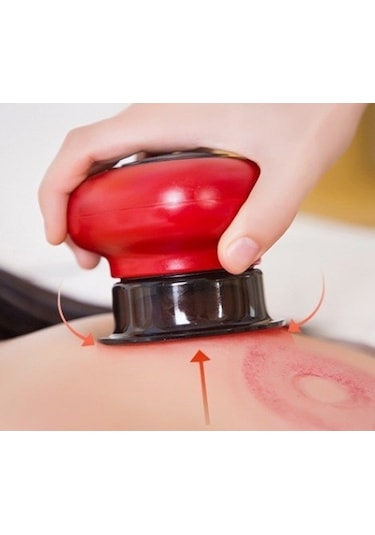 Lichen Elektrikli Hacamat Cihazı, Negatif Basınçlı Kazıma Çok Renkli