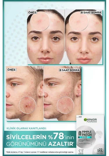 Pimple Patch 22'li Sivilce Bandı / Hidrokolloid Bant / Akne Karşıtı 22li Bant 8690595211459-10607