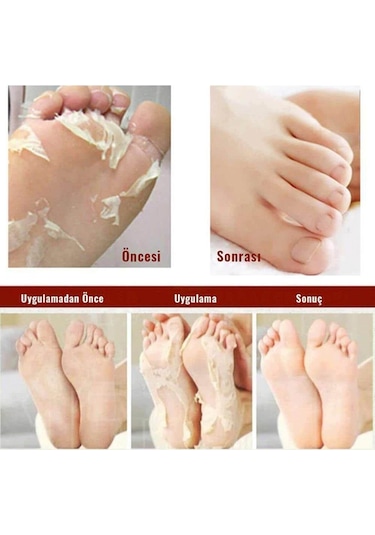 Mjcare Miracle Foot Peeling Pack - Mjcare Çorap Tipi Ayak Peeling Maskesi