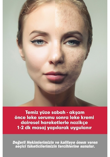 Tto Clınıc Leke Kremi 75ml + Leke Serumu 50ml