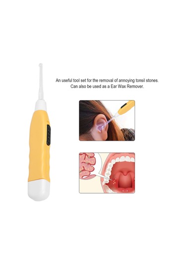 Samdoo Tonil Taşı Kaldırıcı Seti - Led Işıklı Aletler Ve Sulama Şırıngısı İle Akşam Açısı, Yutma Sorunu Giderir