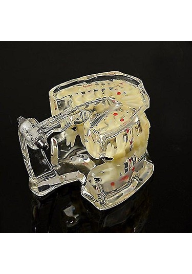 Skycity Diş Hekimi Ve Öğrencilere Özel Reçine Diş Patoloji Gösterim Modeli 1 Adet