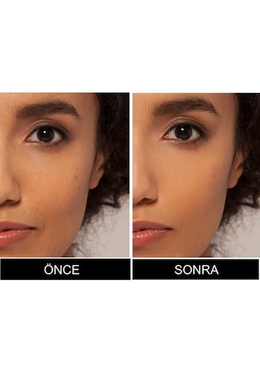 L'Oreal Paris True Match Kapatıcı 7D/W Golden Amber