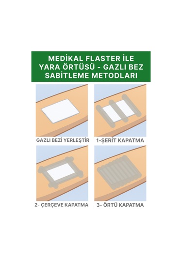 Tıbbi İpek Bant 10cm X 5m, Medikal Sabitleme Flasteri