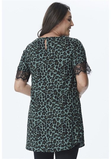 Kolları Dantel V Yaka Tunik-yeşil Yeşil