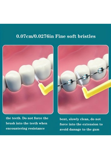 Willowhaven 10 Adet L Şekilli Diş Arası Fırçası - Sarı Paket Oral Temizlik Ve Leke Çıkarıcı