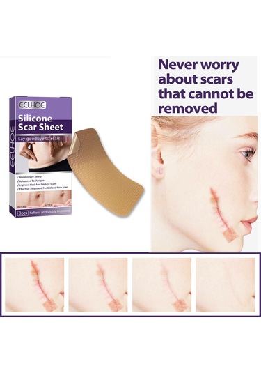 Dolıty Yanık İzleri Skar Yaması Çok Kullanımlı Yumuşak