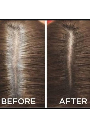 Neva Root Touch Up Saç Dipleri Için Anında Kapatıcı Sprey 75 ML