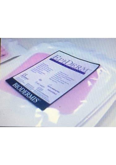 Epi-Derm Epiderm Silikon 28 CM x 40 CM Sheet Jel Tabaka 0.09 CM