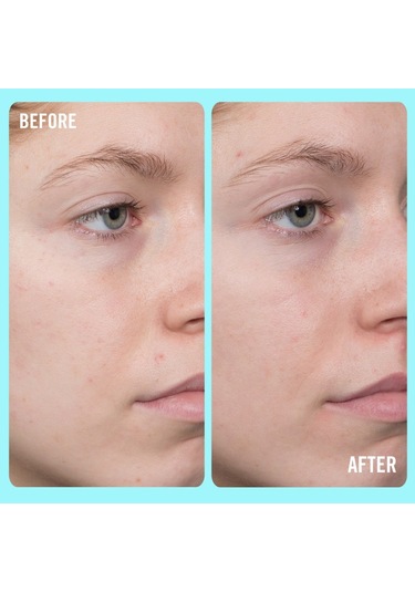 First Aid Beauty 10% Vitamin C Brightening Serum - Aydınlatıcı Serum 50 Ml