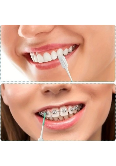 Willowhaven 200 Adet Mavi Diş İpi - Yumuşak Silikon İnterdental Fırça, Etkili Temizlik Ve Hassas Diş Etleri İçin