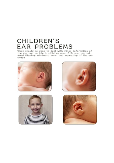 Yaleker Wiieey Bebek Kulak Düzeltme Yapışkanı: Yumuşak Silikon, Nefes Alabilir, Su Geçirmez, Güvenli Ve Rahat Kullanım