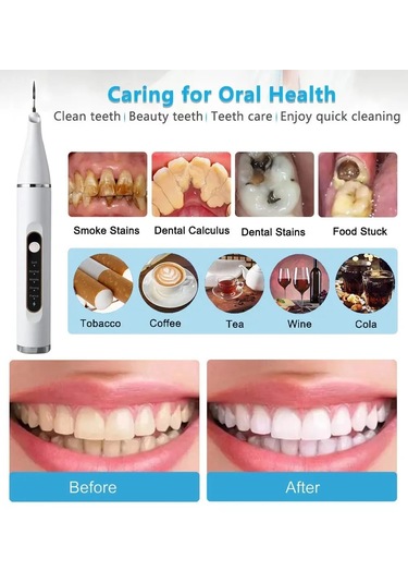 Jialan Ultrasonik Ölçekleyici Diş Scalers Temiz Diş Taşı