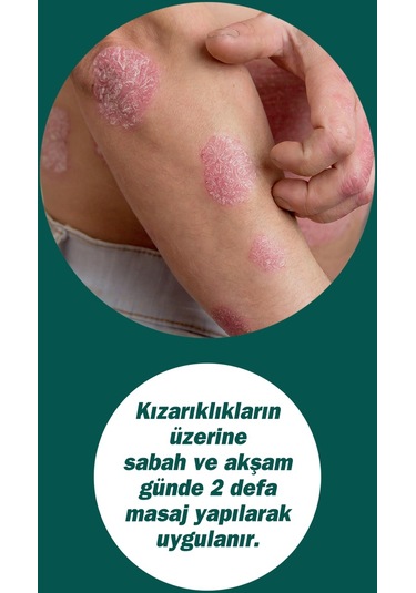 Dermodicos Krem 30 Ml Çay Ağacı Yağı / Tea Tree Oıl