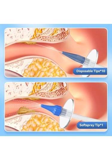 Moveevo Ev İçin Manuel Kulak Yıkama Aleti - Akışı Kontrol Ederek Yumuşakca Kulak Mumu Ve Atık Temizliği, Ev İçi Kulak Bakımı İçin Pratik Ve Hijyenik Beyaz