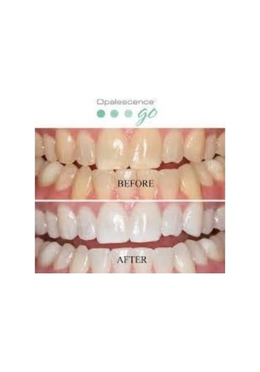 Opalescence Ultradent Go Hazır Kalıp Nane Diş Beyazlatma 8'li