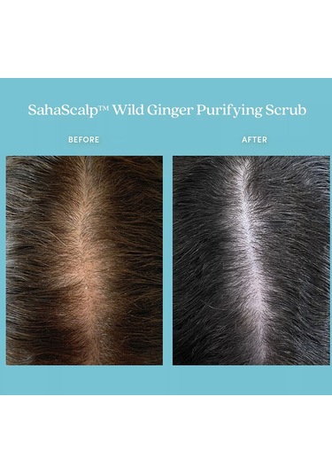 Fable & Mane Sahascalp - Yabani Zencefil İçeren Arındırıcı Peeling 237 Ml